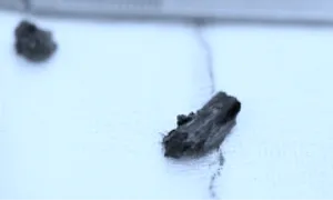 Mẩu gỗ 2 cm nằm một năm trong hốc mắt người đàn ông